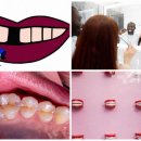 온정치과의원 | 해외 치과와 한국, 야외활동 구강관리, 치실 두께 궁금증 해결!