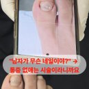 웅비체육관 | 원주네일샵 내성발톱교정 받고 무좀까지 한방에 블링크네일 추천팁 5가지
