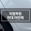 허덴트 이미지