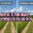 비문증 초기 눈혈류순환제 은행잎나토키나제