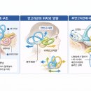 이석증 어지러움 걸려본 후기(이비인후과 운동 치료)