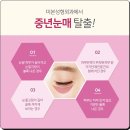 미본 이미지