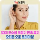 신세계보청기 | 종로보청기 30대 오티콘 오운 프리미엄 초소형 보청기 만족 후기