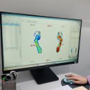 망원역(6) | 발톱 변색 무좀인가 했는데? 독일식 발관리 전문점 마포 레푸스 망원역점 시술 상세 후기