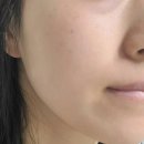 지혜의 샘 | 속건조앰플 수려한 효비담 수분샘 히알루론 콜라겐 볼륨 수분앰플 후기 4050앰플 추천