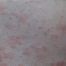 국홍일국정표피부과의원 이미지