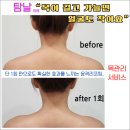 김민재 에스테틱 | 우리 얼굴 알아보기 ㅣ 얼굴 비대칭, 왜 생길까?
