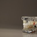 나무정원치과의원 네이버블로그