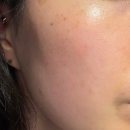 1004 | 고순도 히알루론산 물광앰플 '스킨1004 앰플' 후기 물광부스팅 앰플 추천