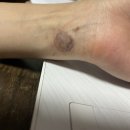 지움의원 이미지