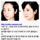 왜 외국인들이 유독 한국인한테만 성형으로 난리칠까?? (feat. 열폭의 산물) 이미지