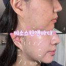 라헬스킨 앤 바디 | 대구 수성구피부관리 미소스킨앤바디 윤곽관리 메디컬 에스테틱 후기
