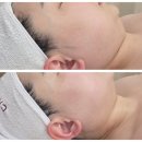 티나스킨앤바디 | [울산] 예쁜티나 스킨앤바디 | 울산달동맞춤관리 탄력관리 후기