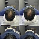 그레이시티 광주직영점 이미지