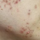 아크네마인드의원 이미지