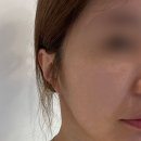 화순 미 의원 네이버블로그