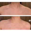 제이라인(J라인) | 대구 만촌역 목어깨관리 추천 :: 30분만 받아도 개운했던 J힐링스파 후기 | 웨딩 어깨라인 관리 추천