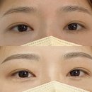 세븐일레븐 순천해룡상삼점 | | 아름담은 | 순천자연눈썹 문신 맛집으로 찐찐 인정! 붉은잔흔 커버 순천눈썹문신 잘하는집