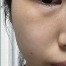 보성유지바이오㈜ | 바이오힐 보 3D 리프팅 피부 탄력크림으로 볼륨감 개선하기