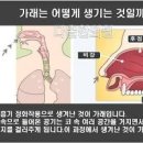 가래 없애는 방법 ＜가래 생기는 이유＞ 가래를 먹어도 되나요 가래 기침에 좋은 음식 이미지