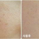 퓨어민 이미지