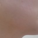 비타민금구의원내 | 내돈내산 유앤아이의원 구로점 첫 방문 후기｜입술필러 입꼬리보톡스부터 제모 이벤트 관리까지 한번에!