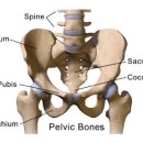 Pubis Fracture의 보존적 치료. 이미지