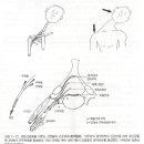 상완신경총 손상(Brachial Plexus Injuries) 이미지