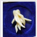 죽파치과 이미지