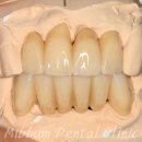 동그라미 치과기공소 이미지