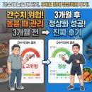 간수치 높을때 관리 식단과 생활 습관으로 3개월 만에 정상화한 후기