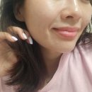 (주)셀포인트 | 강남피부과 피부 속부터 달라지는 재생, 줄기세포주사 자가엑소좀 메타셀 후기