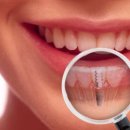 뿌리심는치과의원 이미지