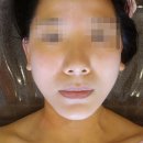 수성솔약국 | [대구/남구] 대명동피부관리실에서 작은 얼굴 및 복부 관리 후기! 라플러스에스떼