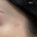 미용인 있어? 나 염색지우는리무버 사용후 이렇게됐는데 이게맞아? 이미지