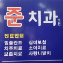 준치과 | 대구 서문시장 준치과에서 사랑니 발치 비용 및 후기