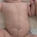 굿모닝연합의원 | 태열,사경,수유패턴 등 소아영유아 심층상담후기,2개월 접종 |광주 굿모닝소아과