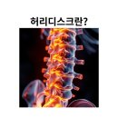 키스톤무브먼트 | 허리디스크 원인과 증상 운동 전문가는 이렇게 생각하고 회원님께 운동법 지도합니다 1편