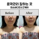 유성대로1689번길 | [대전에스테틱 미소바디앤스킨케어]윤곽관리 잘하는 곳