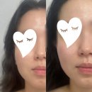 [청당동 에스테틱] 가인뷰티에스테틱 방문후기