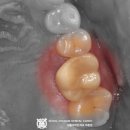 솔치과기공소 이미지