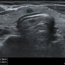 소문난내과의원 이미지