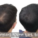 옥정 이미지