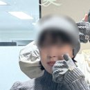 선릉애플치과의원 | [선릉역피부과] &#34;마이미의원&#34; 쥬베룩볼륨 3회차 후기(팔자/땅콩형 시술)