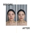괴정초후문 | [부산 괴정] 얼굴 비대칭의 원인이 '어깨’'였다니? AI 윤곽 리셋 후기스페이스뷰티 대티점