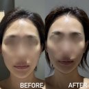 GS25 상무평화점 | 치평동 피부관리 웨딩 윤곽라인 찐 후기, 광주상무점 디바스킨