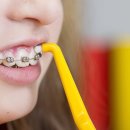 미바른이치과교정과치과의원 이미지