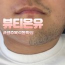 [광주 광산구 흑석동] 남성 페이스 왁싱 받고 온 후기 “광주 흑석동 왁싱” 뷰티온유