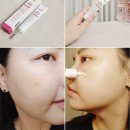 새안심약국 | ​약국멍크림얼굴멍빨리빼는법 디에스 에프터 올인원 케이크림으로 케어해요