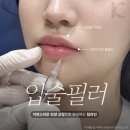 케이스타의원 | 광주입술필러 후기 찾는다면? 수완지구성형외과 가기 전 체크사항은